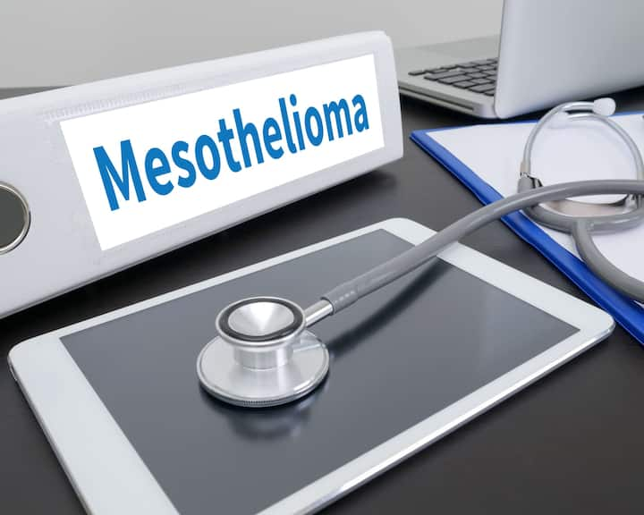 small mesothelioma logo Stages of Mesothelioma